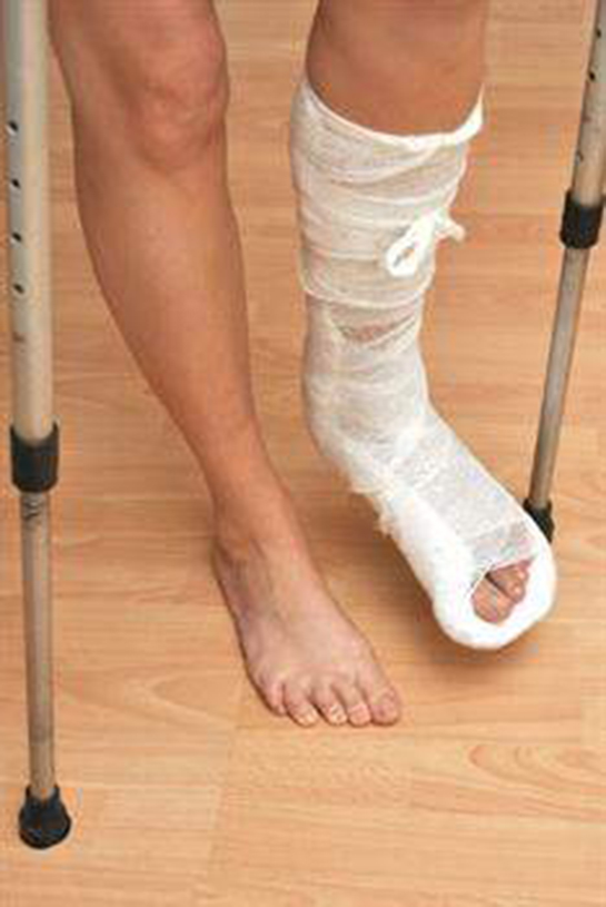Ayak Bileği Kırıkları Ameliyatı ve Sonrası